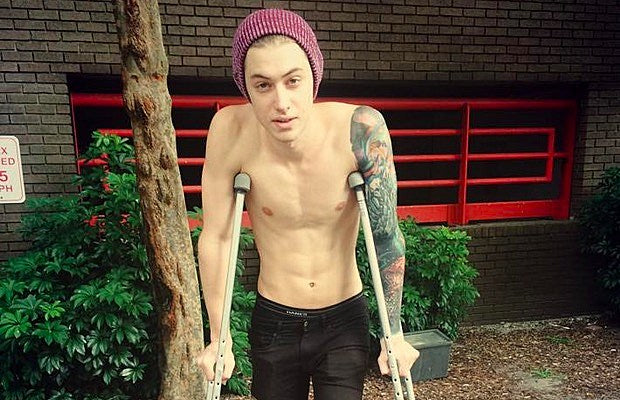 Luke_Holland_-_broken_foot