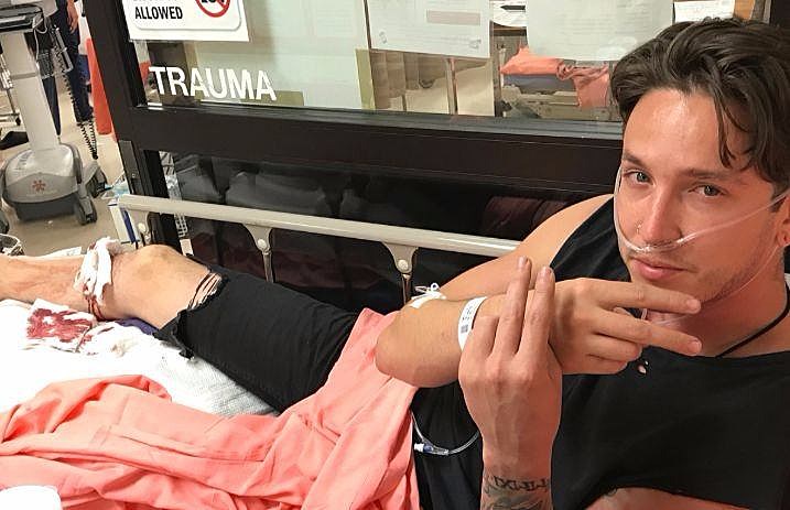 telle_smith_broken_leg